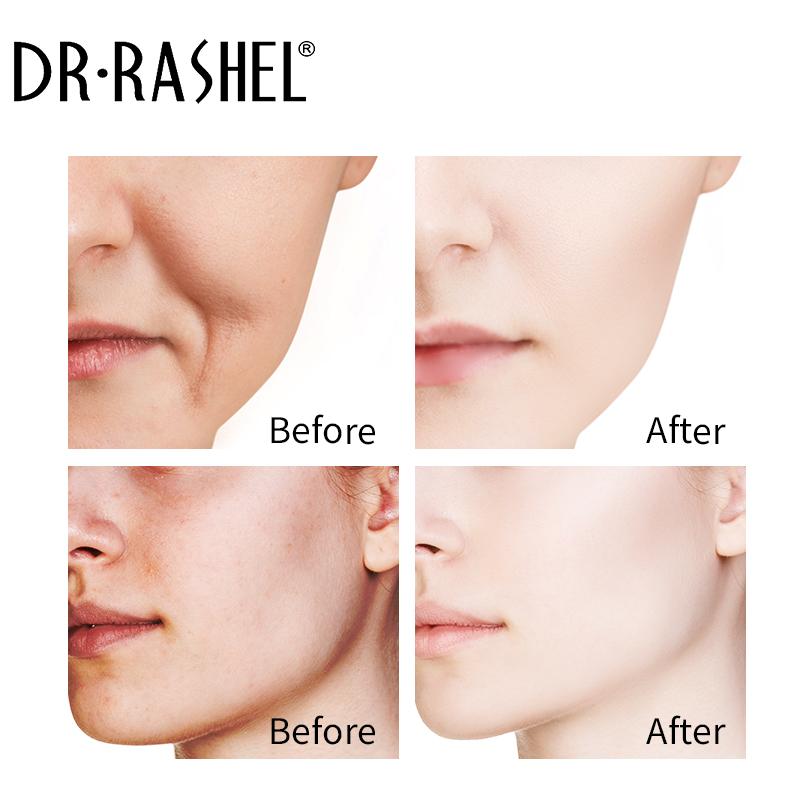 Vitamin C Facial Serum 3 Pack Anti Aging Moisturizing Dr Rashel 2