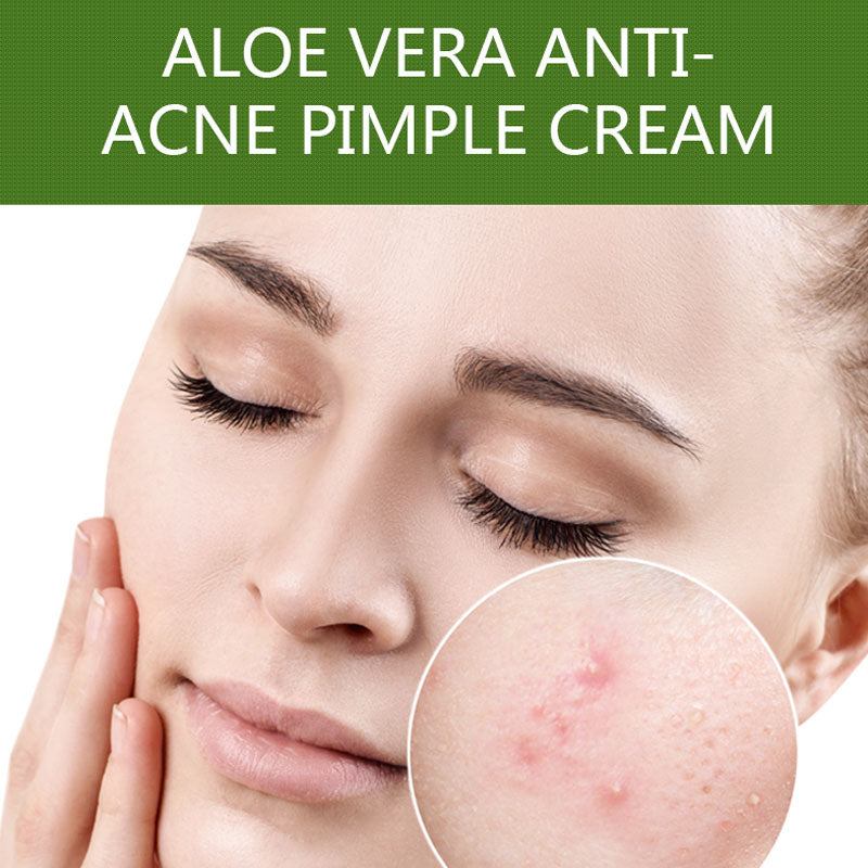 Aloe Vera Anti Acne Pimple Cream 30ml Clear Skin Dr Rashel